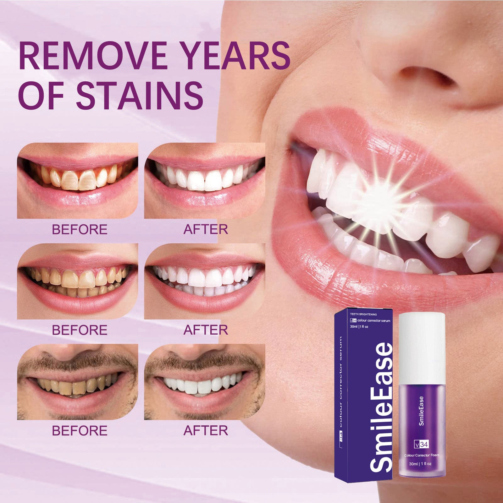 SmileEase™-Teeth Whitening Toothpaste