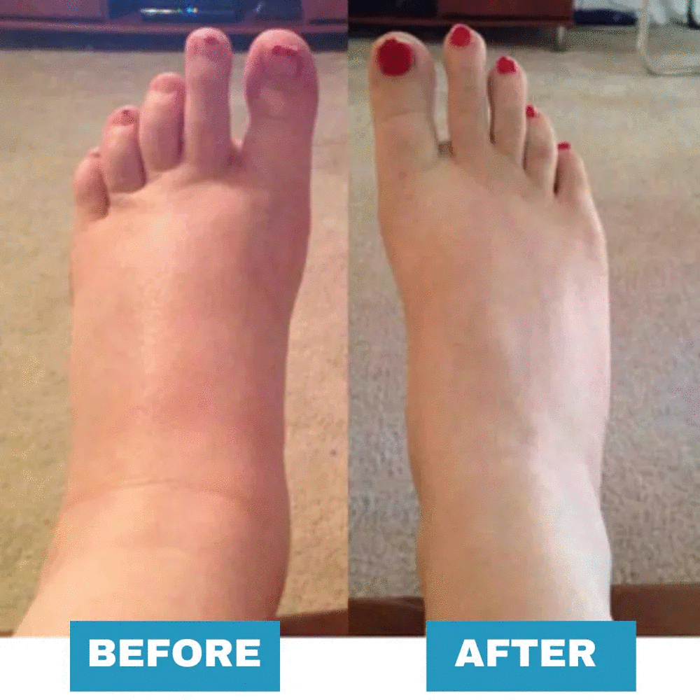 HealthyFeet™ - EMS Foot Massager