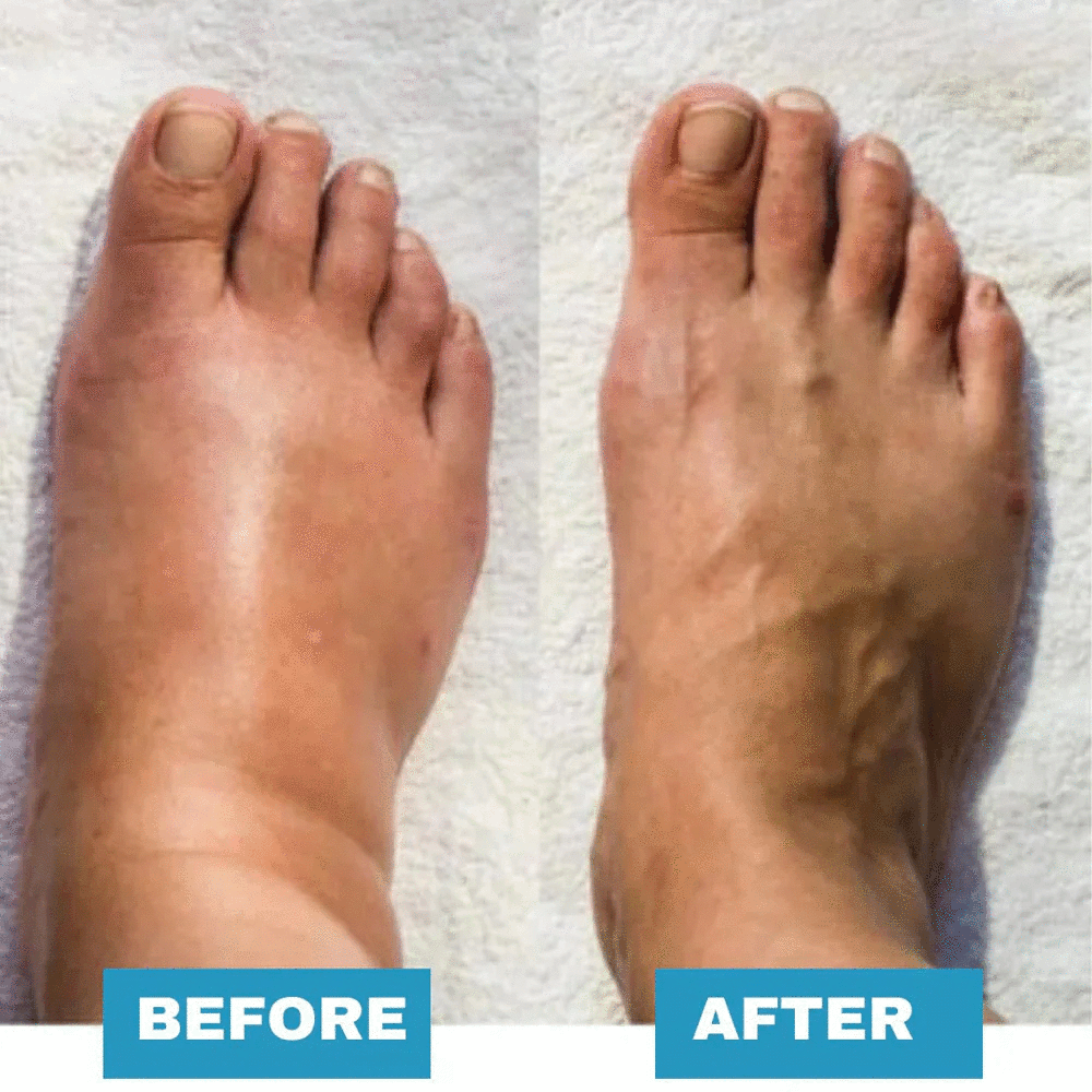 HealthyFeet™ - EMS Foot Massager