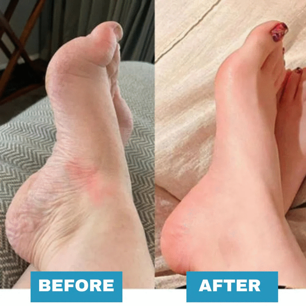 HealthyFeet™ - EMS Foot Massager