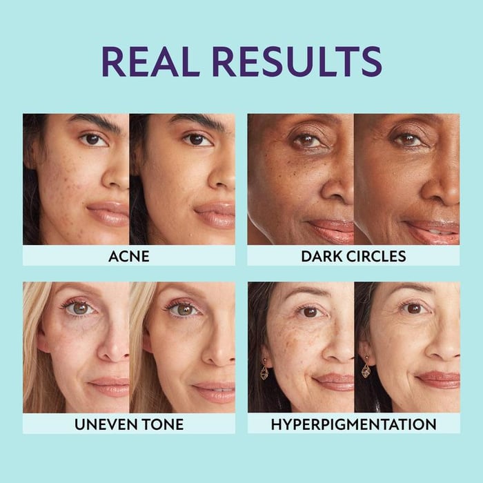 SupremeCrème – Hydrating Concealer with Natural Coverage Finish